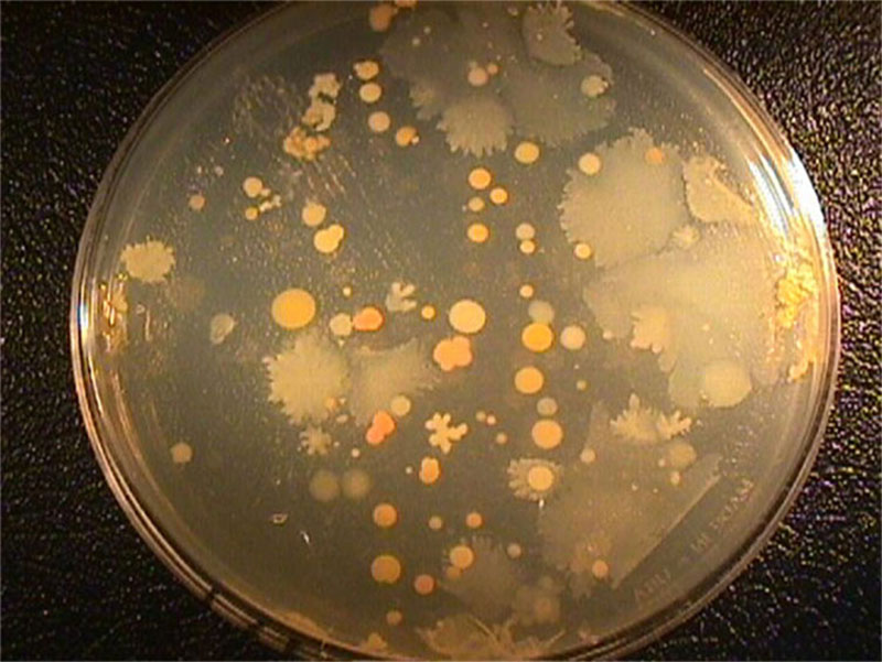 Marine bacteria growing on an agar plate. Image courtesy of Lophelia II 2012 Expedition, NOAA-OER/BOEM. Marine bacteria growing on an agar plate. Image courtesy of Lophelia II 2012 Expedition, NOAA-OER/BOEM.