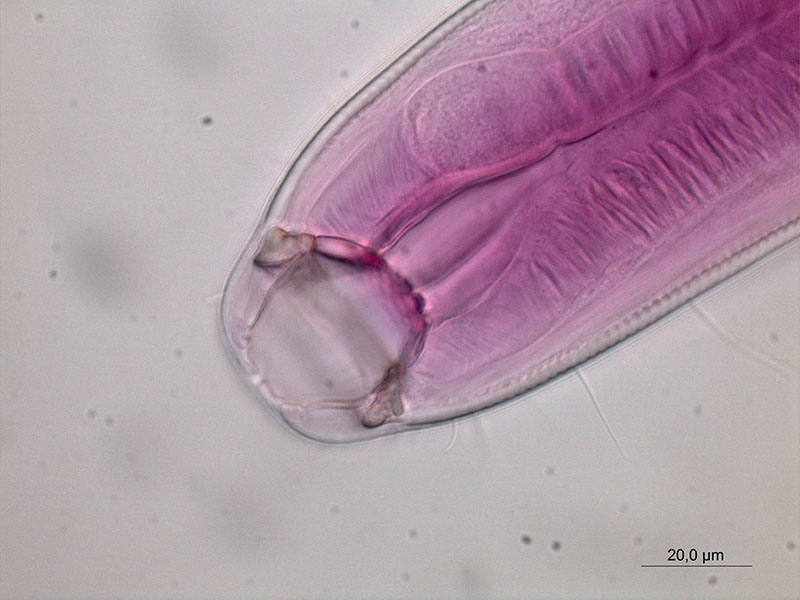 Photograph of a free-living nematode under a compound microscope. The red stain (Rose Bengal) is used to see the organs and other structures more clearly under the microscope. This specimen has distinct jaws and a muscular esophagus, suggesting this species preys on or scavenges on remains of other meiofauna organisms. Photograph of a free-living nematode under a compound microscope. The red stain (Rose Bengal) is used to see the organs and other structures more clearly under the microscope. This specimen has distinct jaws and a muscular esophagus, suggesting this species preys on or scavenges on remains of other meiofauna organisms.